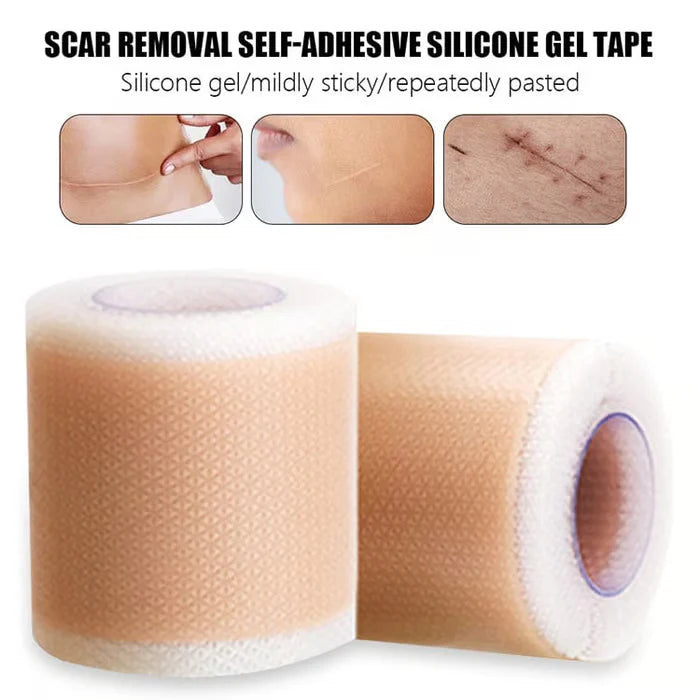 Silicone Scar Sheets, Silicon gel sheets for Scars Transparent Medical Silicone Gel Tape