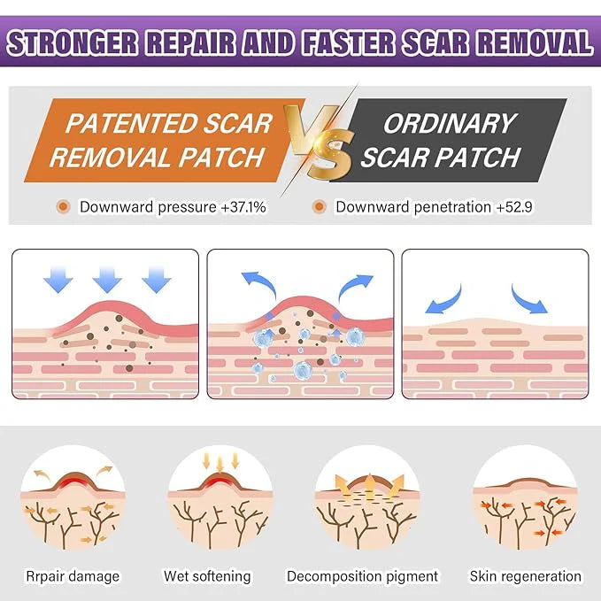 Silicone Scar Sheets, Silicon gel sheets for Scars Transparent Medical Silicone Gel Tape